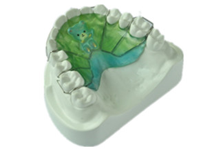 Dental Hawley Retainer with with Ball Clasps - DDS Lab's Orthodontic Products