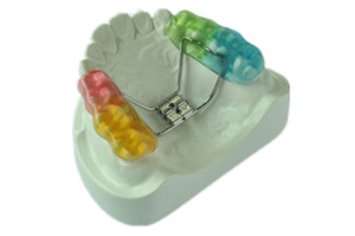 Dental San Antonio Wraparound Retainer - DDS Lab's Orthodontic Products