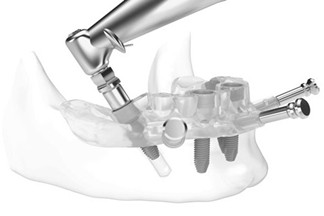 Dental Implants & Surgical Guides